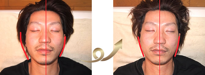 男性の頭蓋骨・小顔矯正もお任せください!