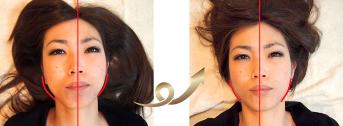 顎関節でお困りなら顎関節矯正でここまで変化します!